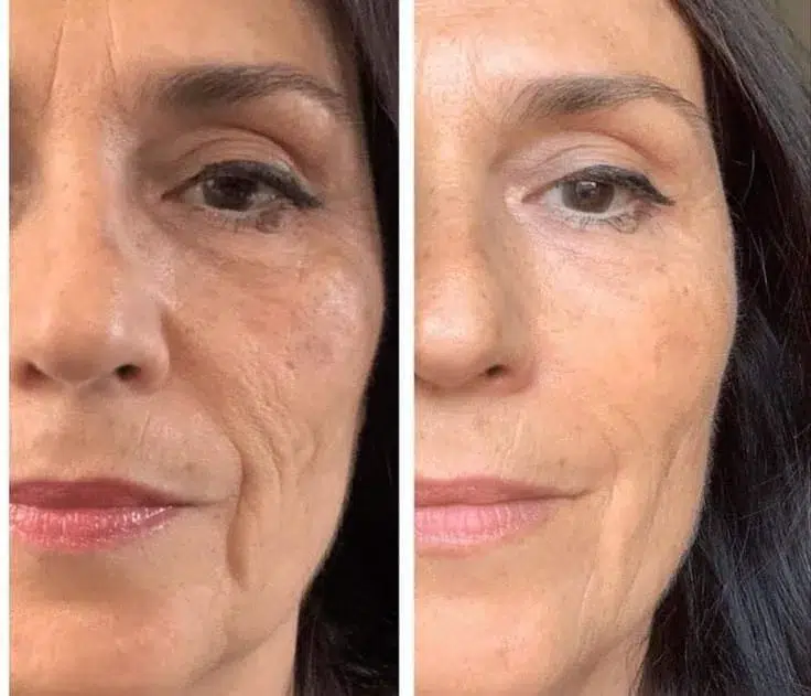 Risultato BIOREMOVE