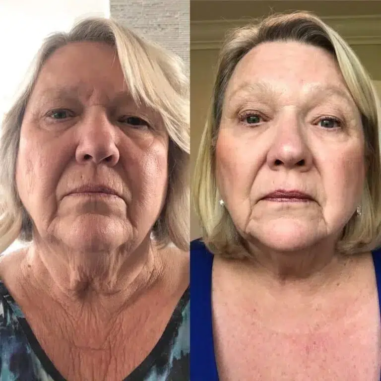 Risultato BIOREMOVE