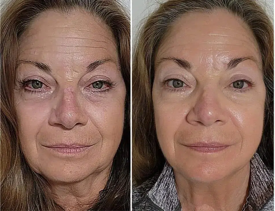 Risultato BIOREMOVE