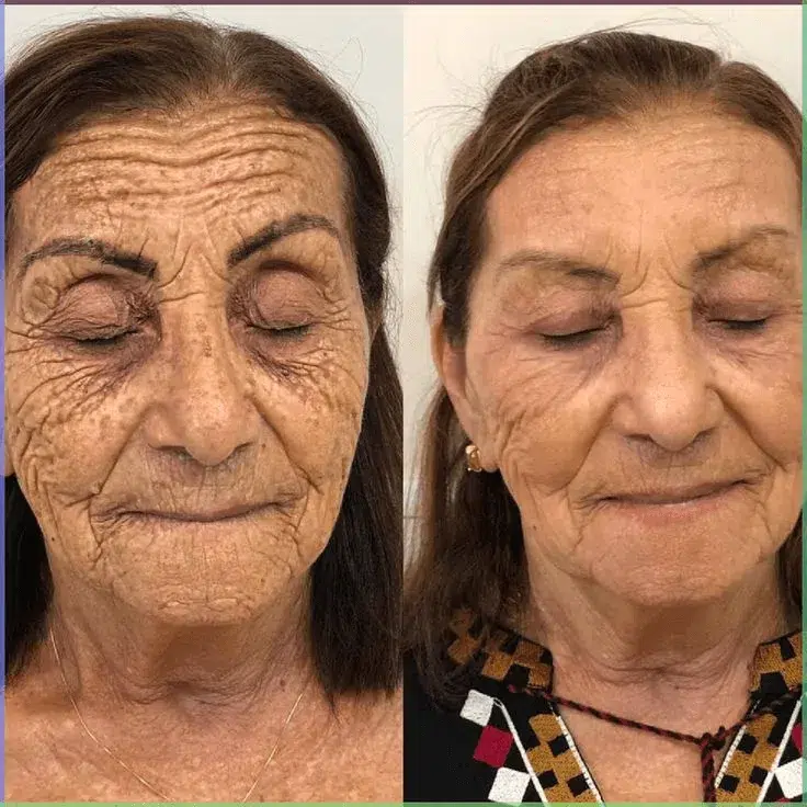 Risultato BIOREMOVE